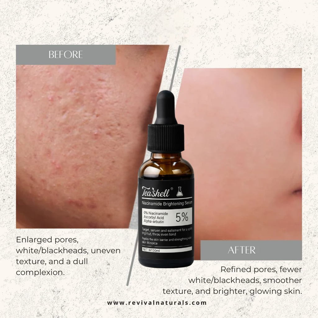 Teashell Niacinamide Glow Serum | (Buy Now)