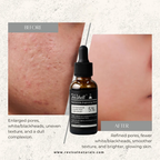 Teashell Niacinamide Glow Serum | (Buy Now)