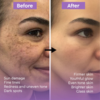 Teashell Niacinamide Glow Serum | (Buy Now)