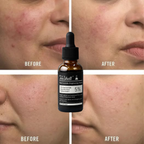 Teashell Niacinamide Glow Serum | (Buy Now)