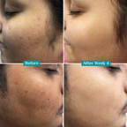 Teashell Niacinamide Glow Serum | (Buy Now)
