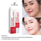 Chalonese Cream | Anti Pigmentation & Acne Cream