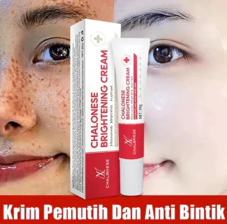 Chalonese Cream | Anti Pigmentation & Acne Cream